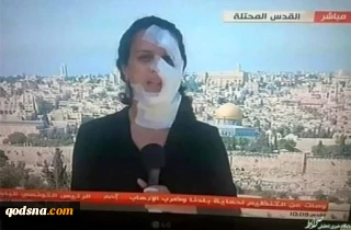 گزارش خبرنگار المیادین با صورت زخمی شده توسط صهیونیست ها+ عکس