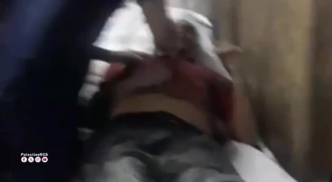 تداوم حملات سنگین رژیم صهیونیستی به غزه تداوم حملات سنگین رژیم صهیونیستی به غزه