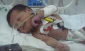 Gaza kids born with defects following 22-day war