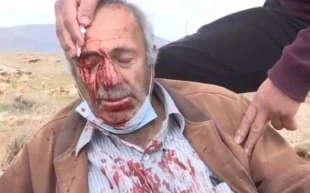 حمله وحشیانه شهرک نشینان صهیونیست به کشاورزان فلسطینی/ یک مرد سالخورده و پسرش به شدت مجروح شدند/ یورش نظامیان صهیونیست به فلسطینیان مخالف حضور نتانیاهو در ناصره 2