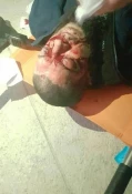 منابع فلسطینی اعلام کردند:

مجروحیت 59 فلسطینی در درگیری های مسجد الاقصی+تصاویر 3