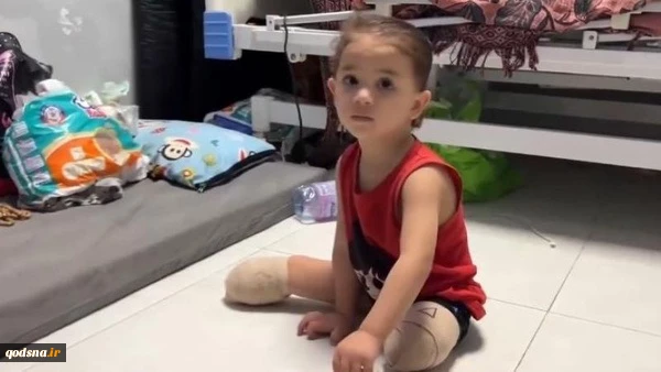 سازمان بهداشت جهانی: 4 هزار و 50 عمل قطع عضو در غزه انجام شده است 2