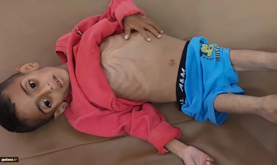 GMO: 66 Palestinian children die of malnutrition in Gaza