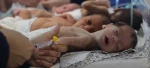 UNRWA: One in 10 children in Gaza suffering from malnutrition