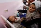 افزایش بی‌سابقه فلج عضلانی حاد در غزه