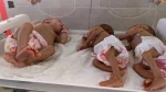منابع پزشکی فلسطینی گزارش دادند:
سوءتغذیه شدید ۱۷ هزار کودک فلسطینی/ یک کودک شیرخواره دیگر شهید شد 2