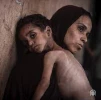 سوء‌تغذیه شدید ۱۷ هزار کودک در غزه و سرقت کمک‌ها توسط گروهک‌های مسلح 2