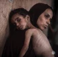 سوء‌تغذیه شدید ۱۷ هزار کودک در غزه و سرقت کمک‌ها توسط گروهک‌های مسلح 2