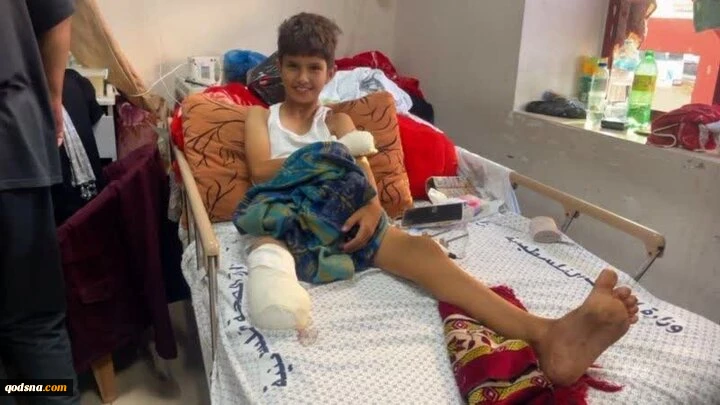 افزایش ۲۲۵ درصدی قطع عضو در غزه؛ بیمارستان شیخ حمد در آستانه فروپاشی درمانی 2