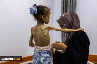 شهادت 5 نفر دیگر در اثر سوء تغذیه در غزه