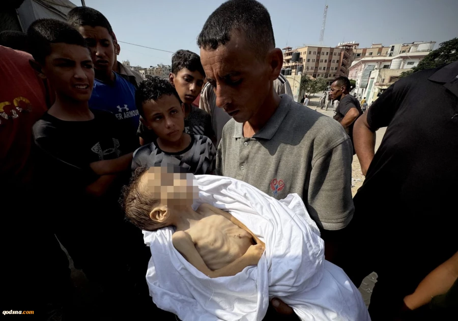 Starvation kills another Gaza child raising famine martyr toll to 227