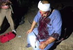 حملات شهرک نشینان صهیونیست به رام الله و الخلیل/ زخمی شدن چند فلسطینی و به آتش کشیده شدن منازل و خودروهای آنها 2