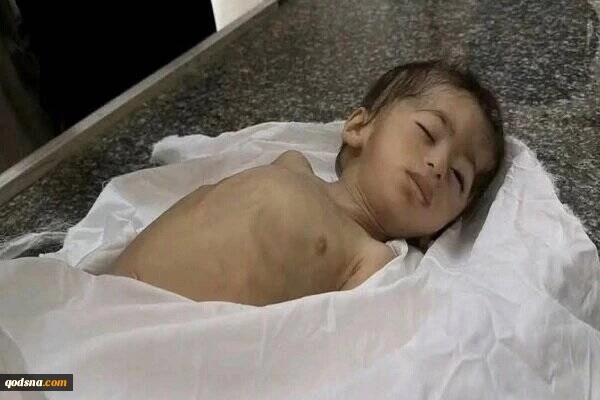 هشدار آنروا: سوء تغذیه کودکان غزه شدت گرفته است 2