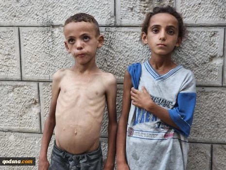 Martyr toll from starvation climbs to 303, including 117 kids