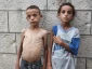 Martyr toll from starvation climbs to 303, including 117 kids
