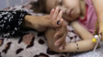 10 حالات وفاة بينهم طفلان بسبب المجاعة 2