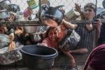 شهادت ۳۳۰ نفر در غزه بر اثر گرسنگی و سوء تغذیه 2