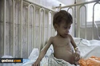 شیوع شدید بیماری کبدی در غزه