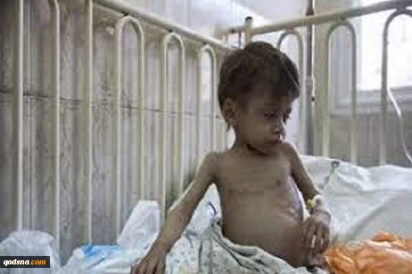 شیوع شدید بیماری کبدی در غزه؛ کمبود واکسن و آزمایش
 2