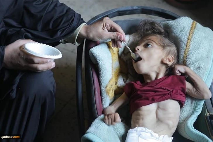 WHO: Gaza faces escalating famine risk