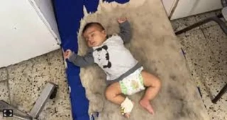 هشدار درباره شیوع مننژیت در کودکان غزه