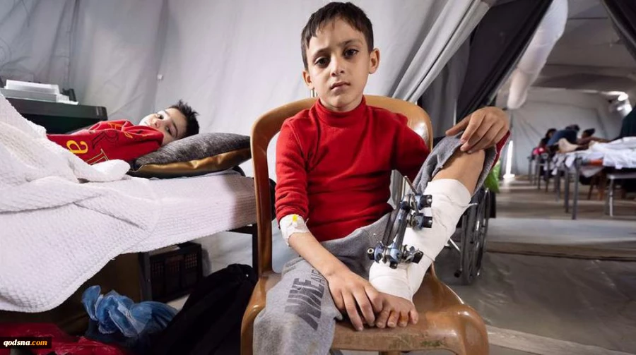 More than 43,000 suffered life-threatening injuries during Israeli genocidal war in Gaza: WHO