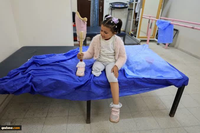 قطع عضو حدود ۸۰۰۰ نفر در جریان جنگ غزه