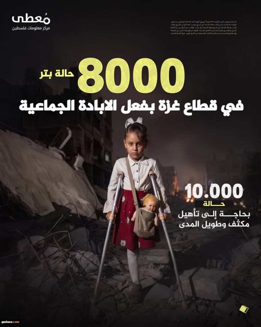 8000 قطع عضو از ابتدای جنگ علیه غزه+عکس 2